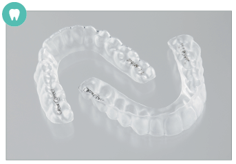 マウスピース型装置の適応症